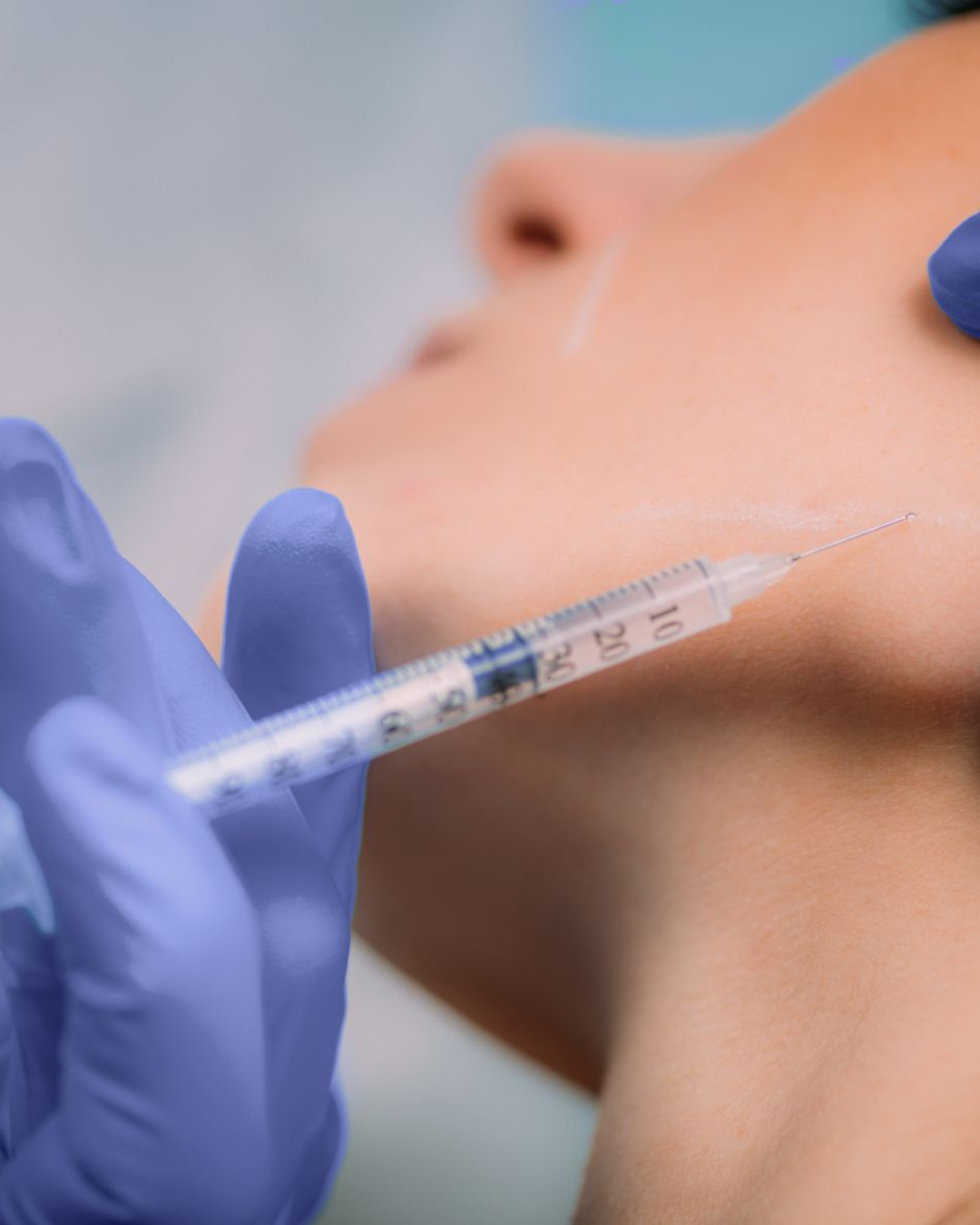 Precio del botox en Madrid: qué factores lo determinan y por qué no debe ser el único criterio