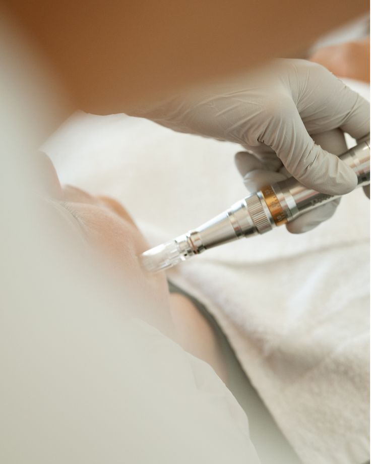 Tratamiento con exosomas: precio, número de sesiones y qué resultados son realistas