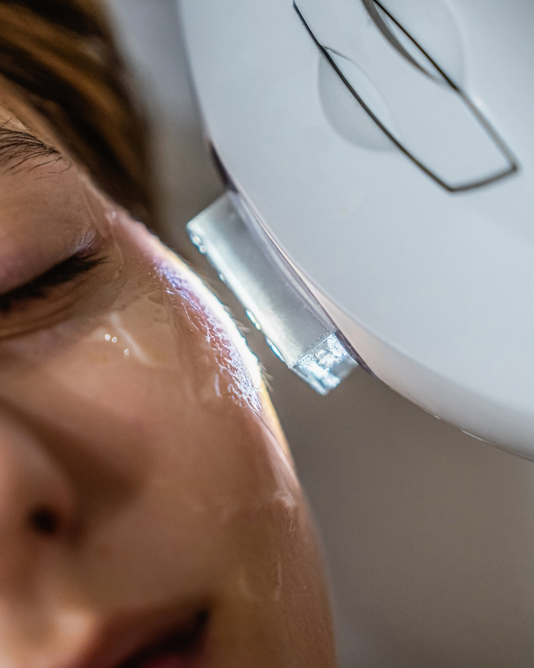 Fotorejuvenecimiento IPL — Elimina Manchas, Rojeces y Recupera la Luminosidad de tu Piel