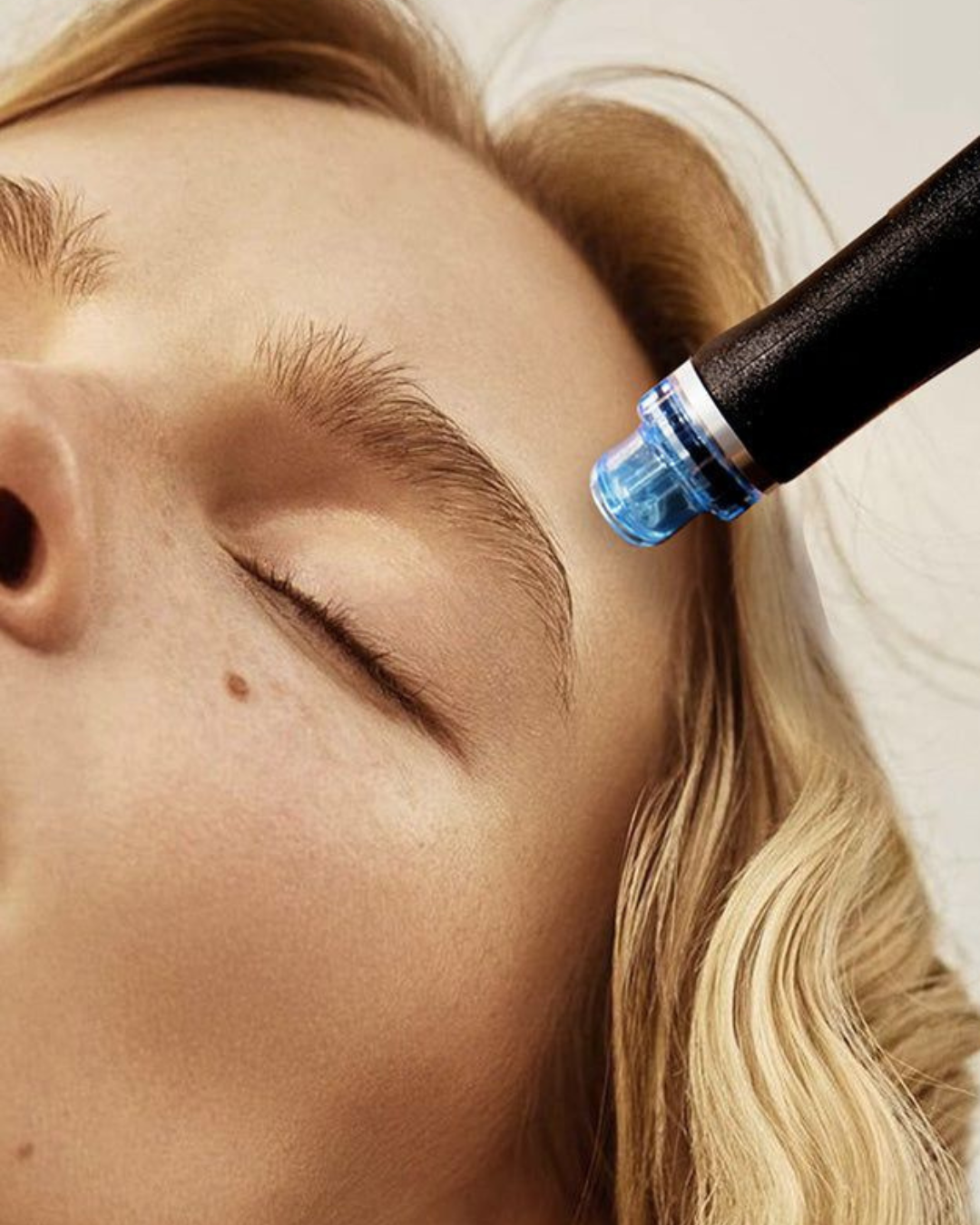 Precio del HydraFacial en Madrid: qué incluye una sesión y cuántas necesitas