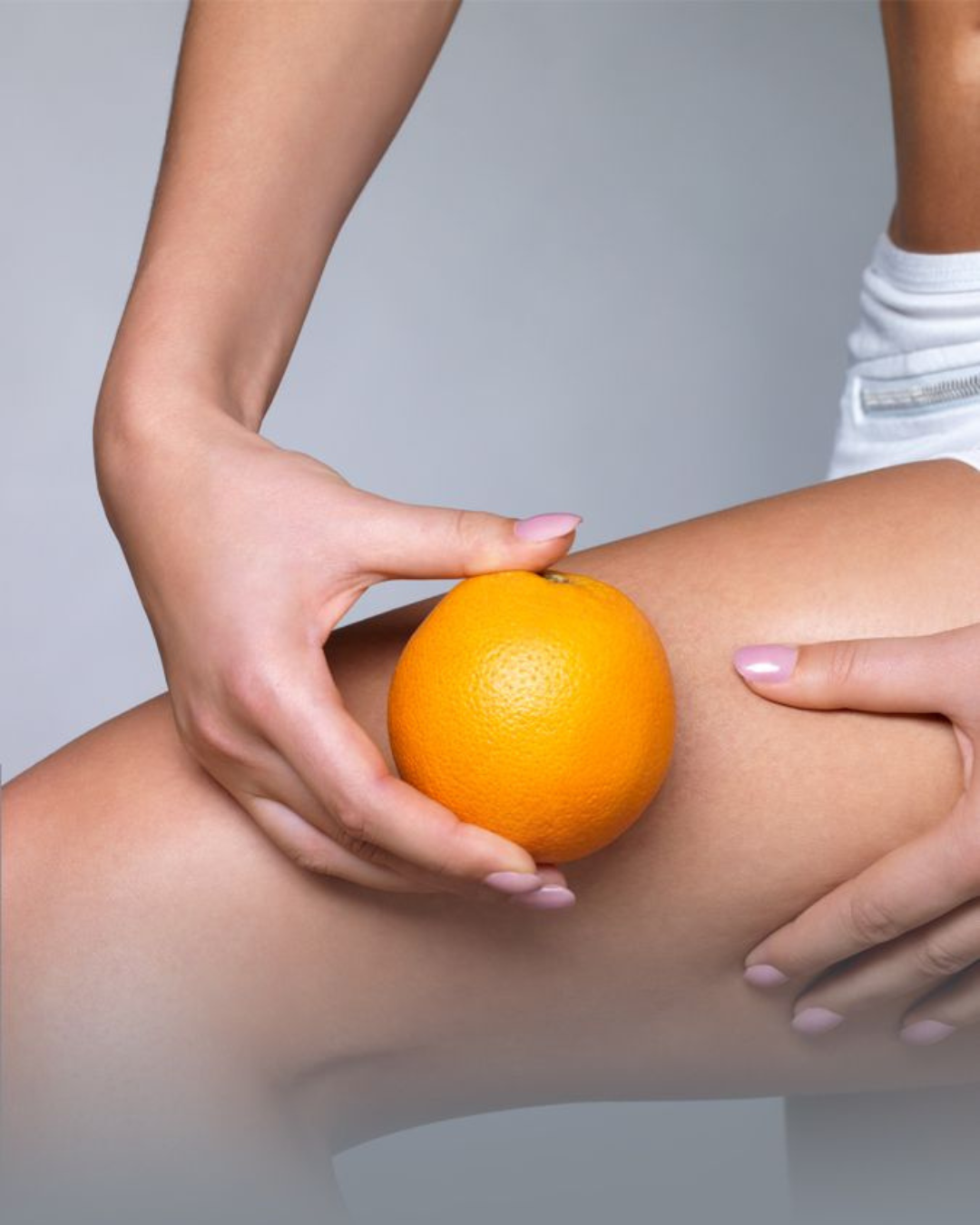 Piel de Naranja vs Celulitis: Diferencias y Soluciones