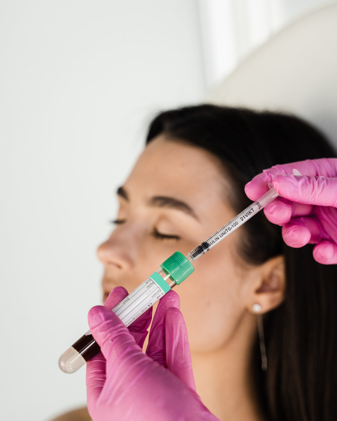Tratamiento PRP: tratamientos con plasma rico en plaquetas