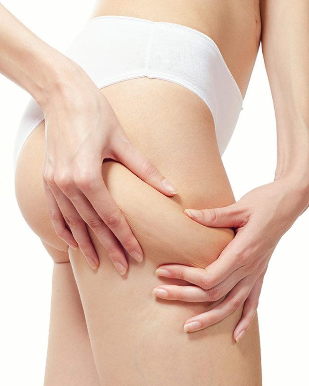 Celulitis Fibrosa: Rompe los Nódulos de Grasa más Duros