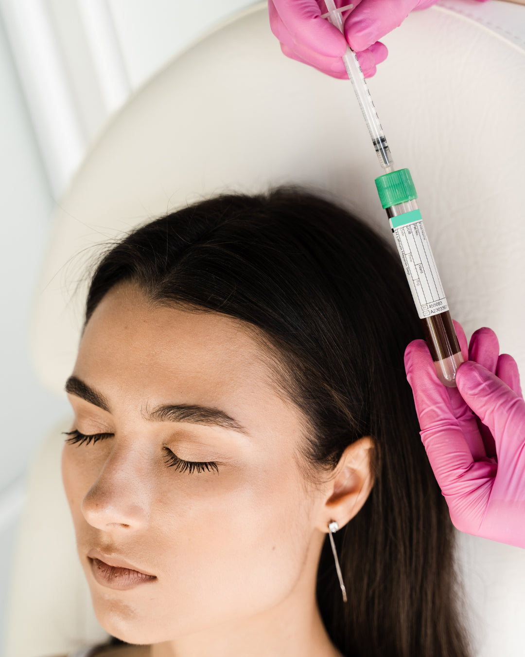 Beneficios del PRP Facial: Rejuvenece tu Piel con Plasma Rico en Plaquetas