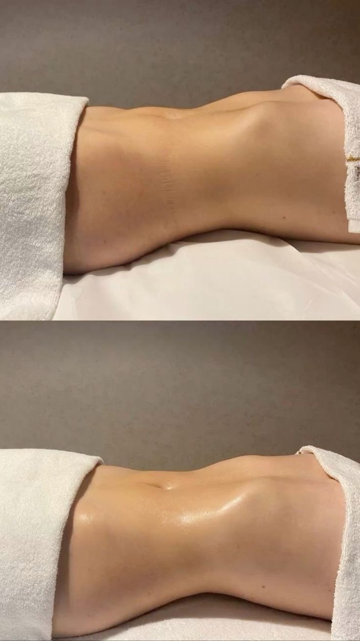 Presoterapia Profesional: el secreto del drenaje en tu Circuito Corporal Avanzado.
