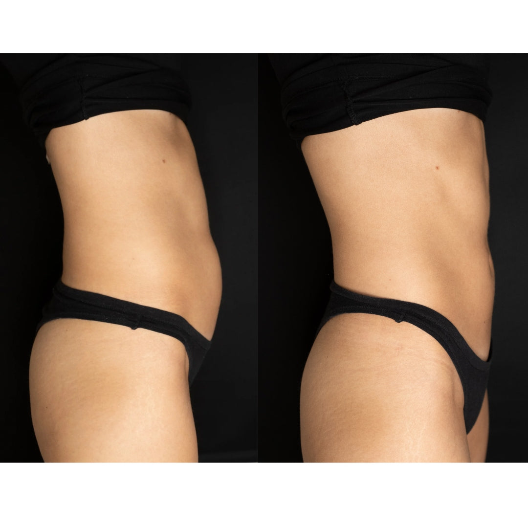 Embody + Técnica Manual (60 min)