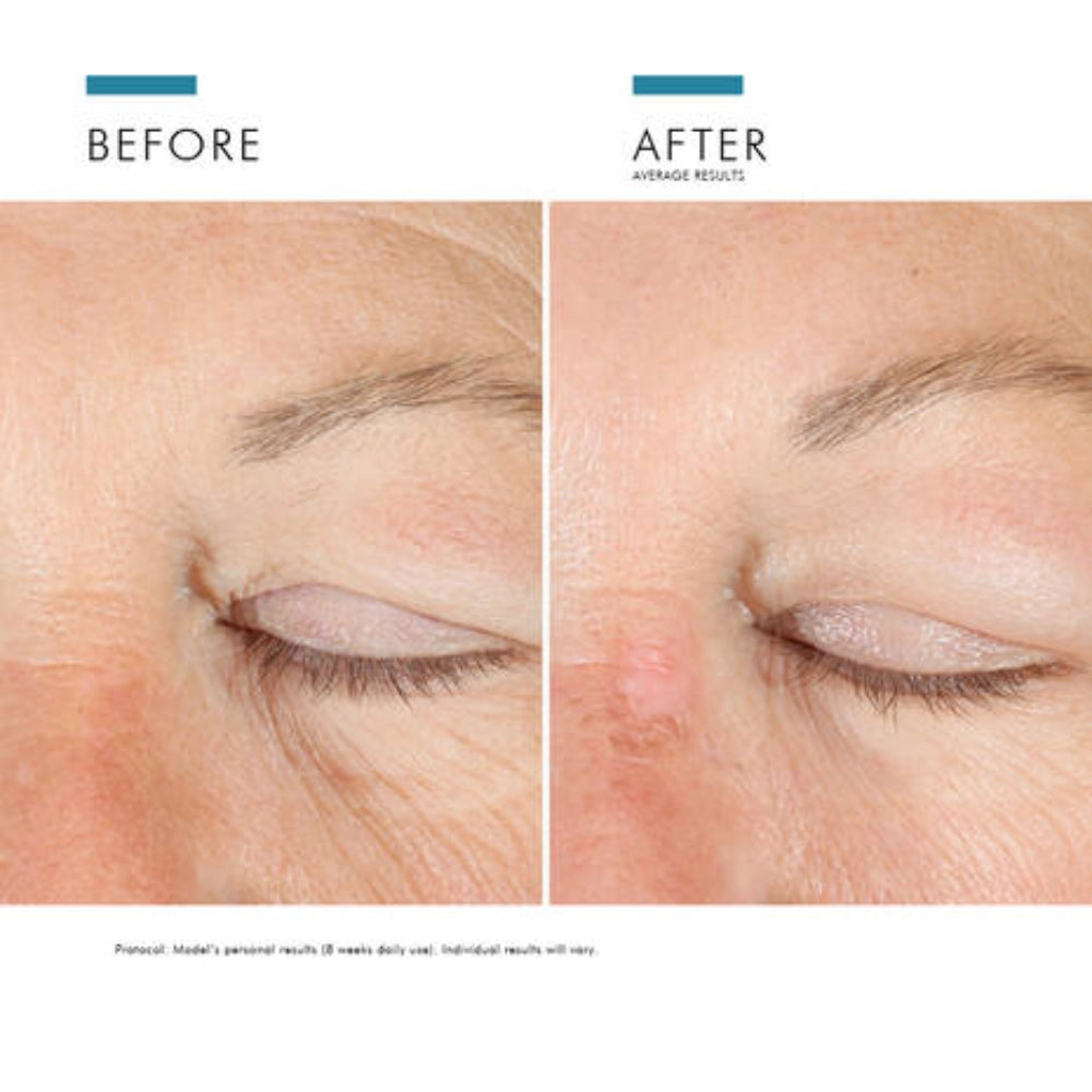 A.G.E. Eye Complex