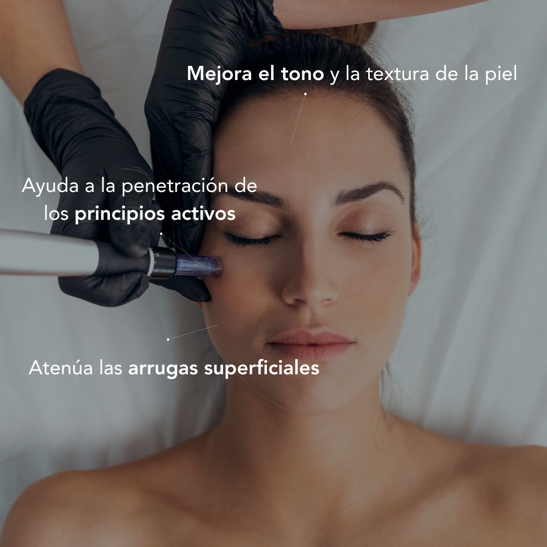 Facial dermapen