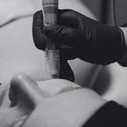 Dermapen Facial Gift Card