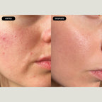 Tarjeta regalo detox facial