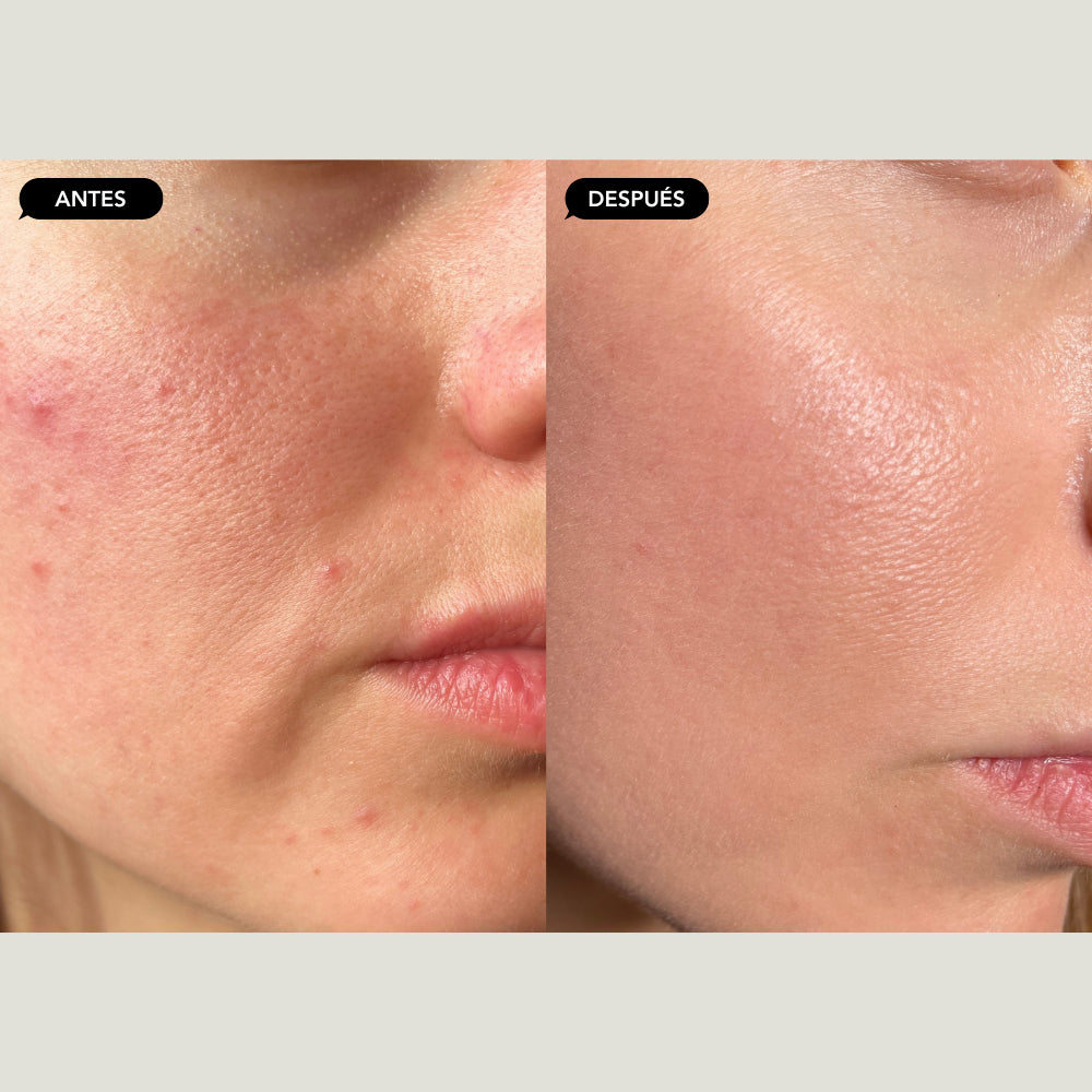 Detox facial
