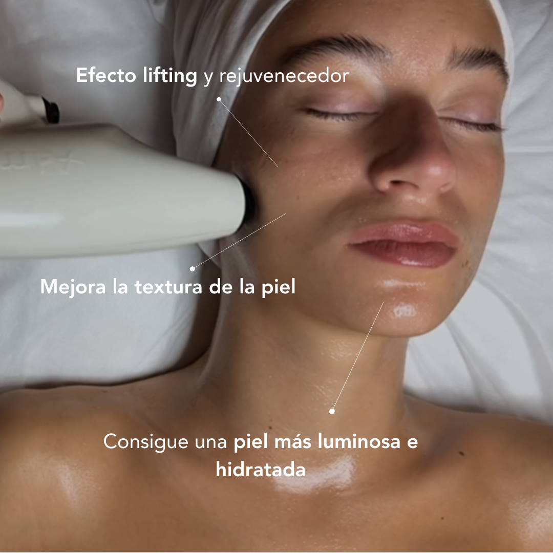 Tratamiento facial accent prime