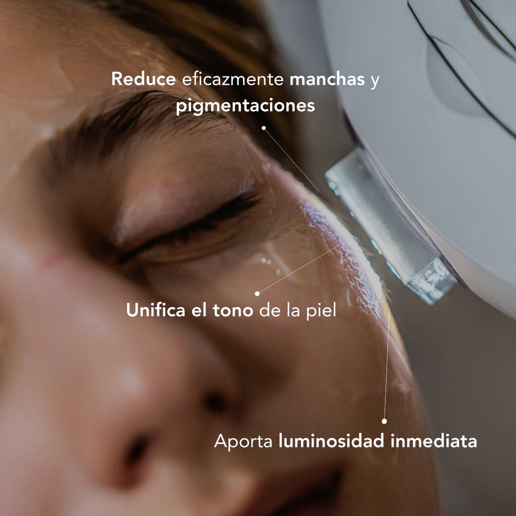 IPL Anti-Blemish Treatment
