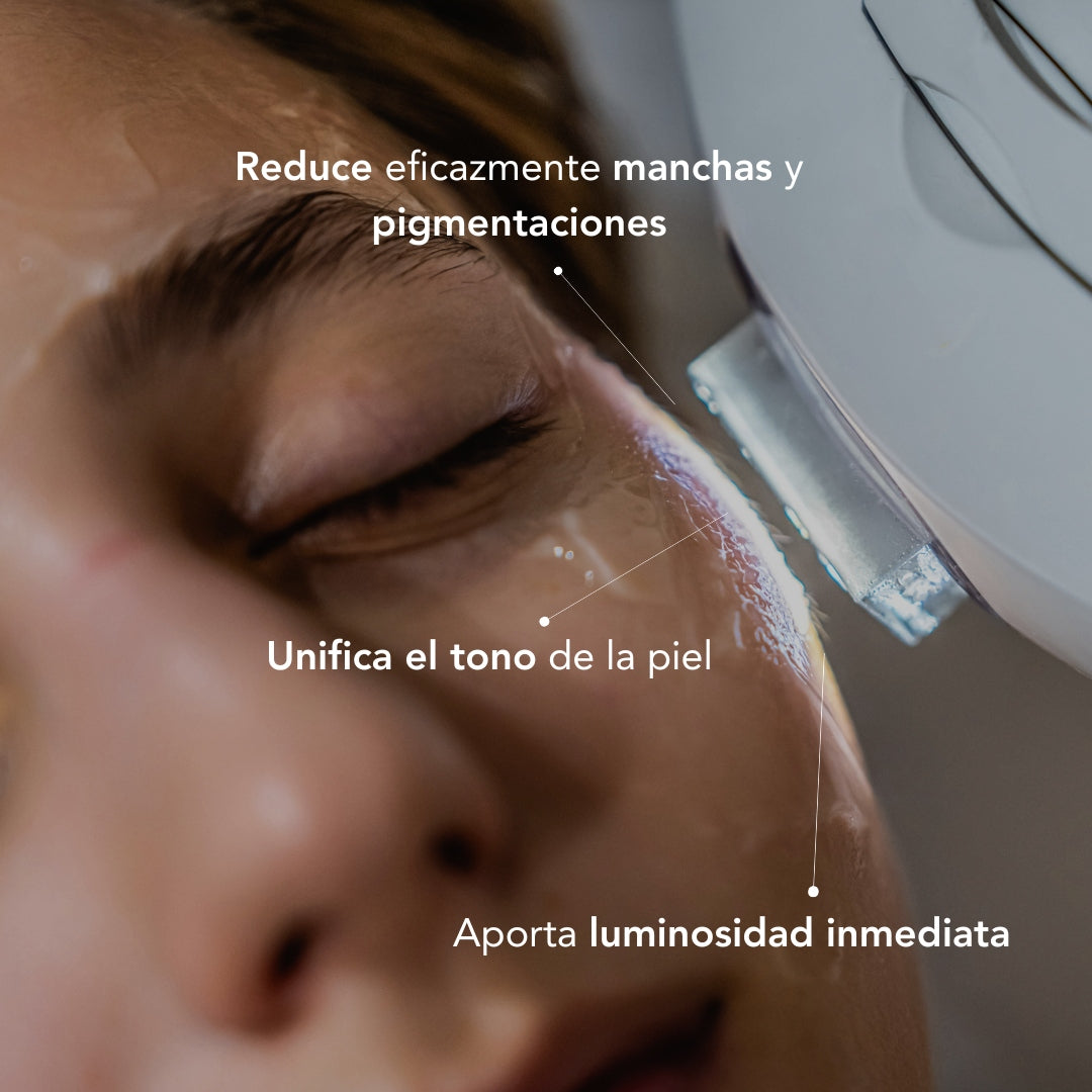 IPL Anti-Blemish Treatment