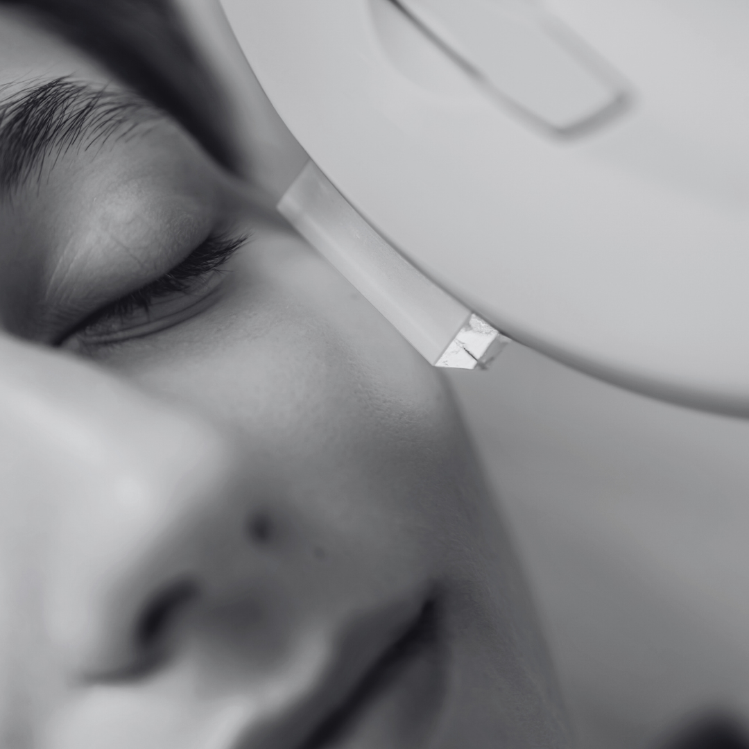 IPL Anti-Imperfection Treatment