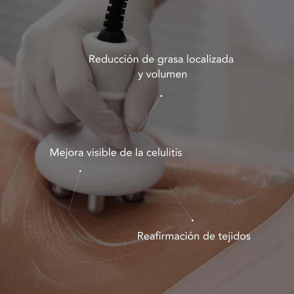 Método Beldon