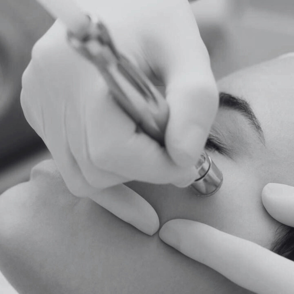Microdermabrasion