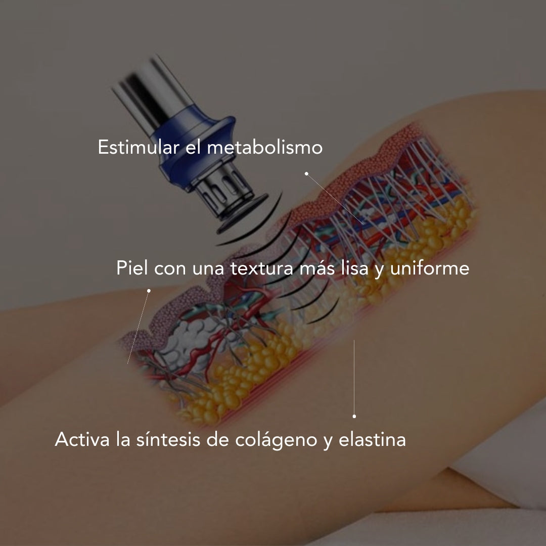 Ondas de choque