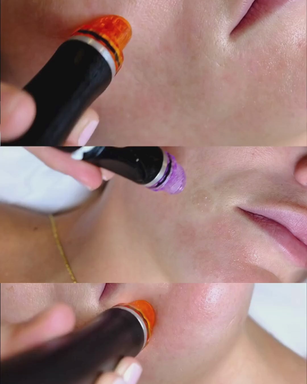 Hydrafacial Signature