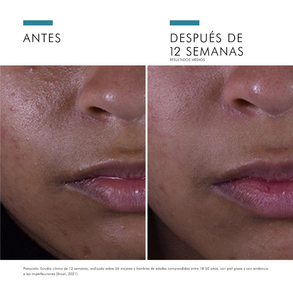 Silymarin CF