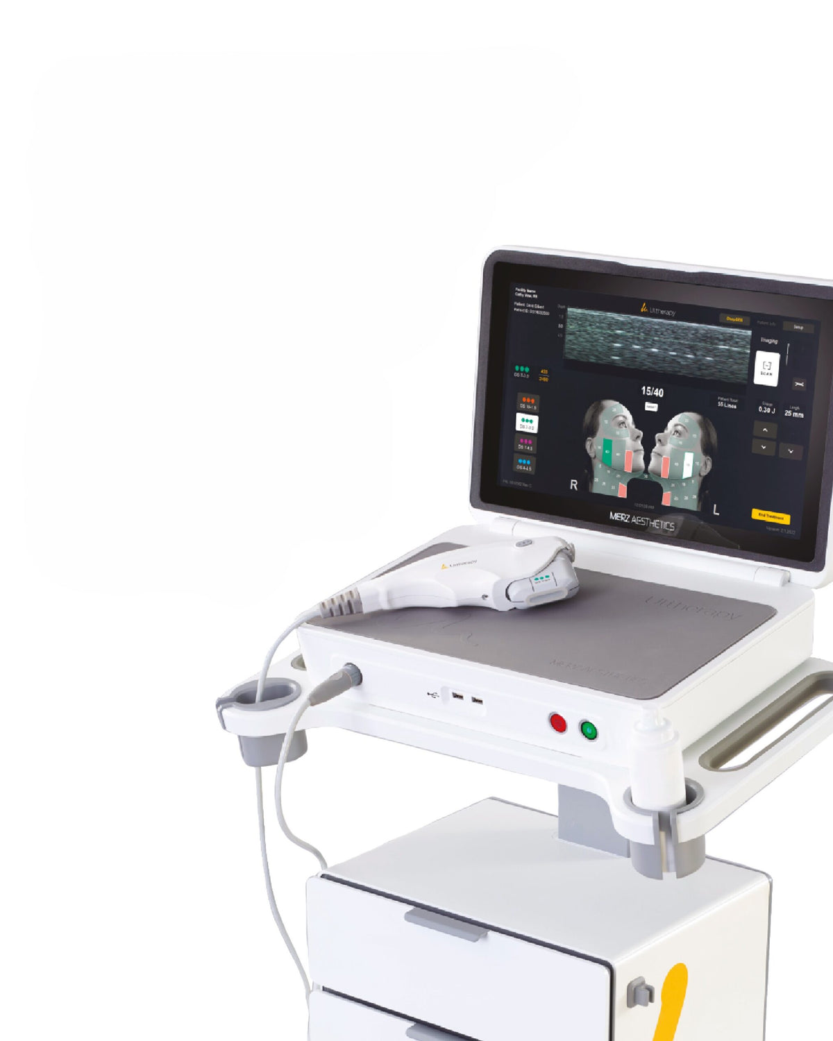 Ultherapy Prime Periocular Zone